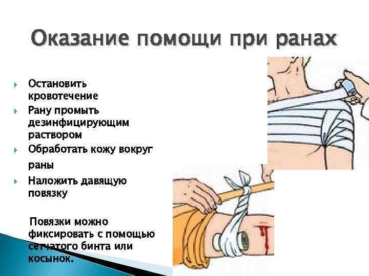 Оказание помощи при ранах Остановить кровотечение Рану промыть дезинфицирующим раствором Обработать кожу вокруг раны