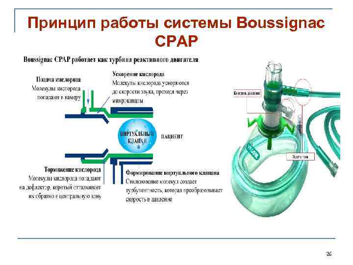 Принцип работы системы Boussignac СРАР 26 