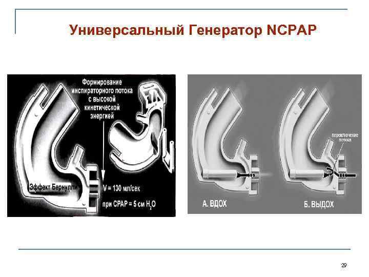 Универсальный Генератор NCPAP 29 