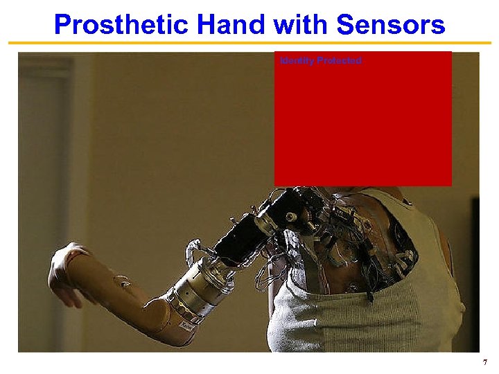 Prosthetic Hand with Sensors Identity Protected 7 
