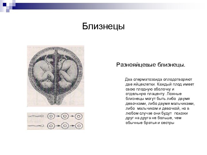 Близнецы Разнояйцевые близнецы. Два сперматозоида оплодотворяют две яйцеклетки. Каждый плод имеет свою плодную оболочку