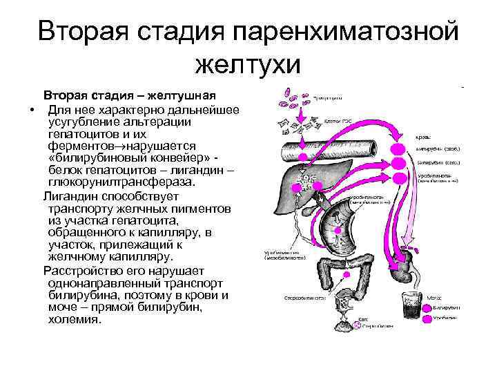 Вторая стадия паренхиматозной желтухи Вторая стадия – желтушная • Для нее характерно дальнейшее усугубление