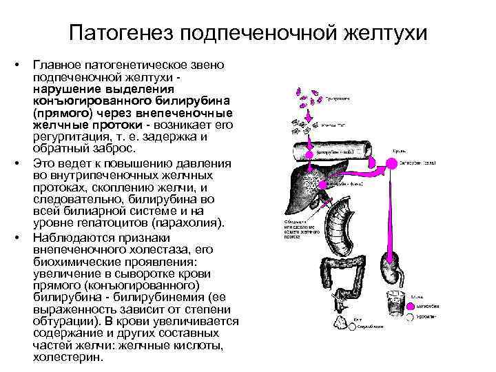 Патогенез подпеченочной желтухи • • • Главное патогенетическое звено подпеченочной желтухи нарушение выделения конъюгированного