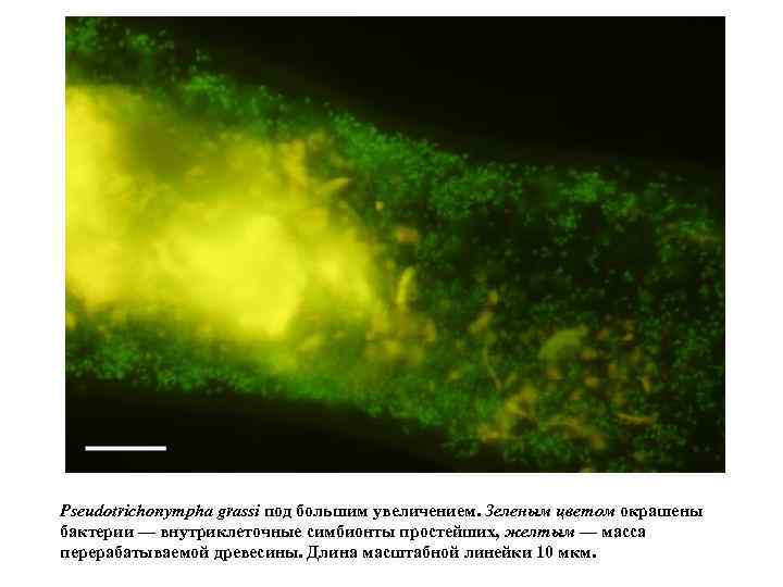 Pseudotrichonympha grassi под большим увеличением. Зеленым цветом окрашены бактерии — внутриклеточные симбионты простейших, желтым