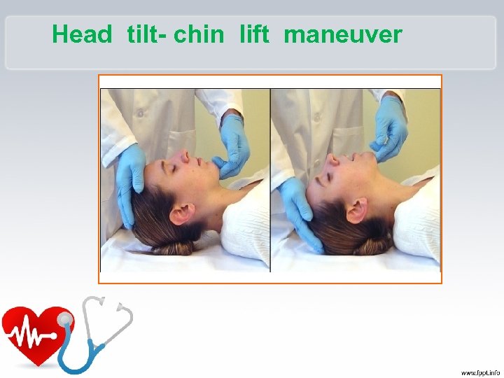 Head tilt- chin lift maneuver 