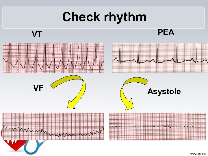 Check rhythm VT VF PEA Asystole 
