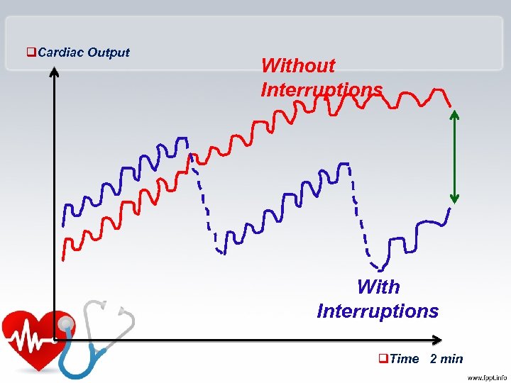 q. Cardiac Output Without Interruptions With Interruptions q. Time 2 min 