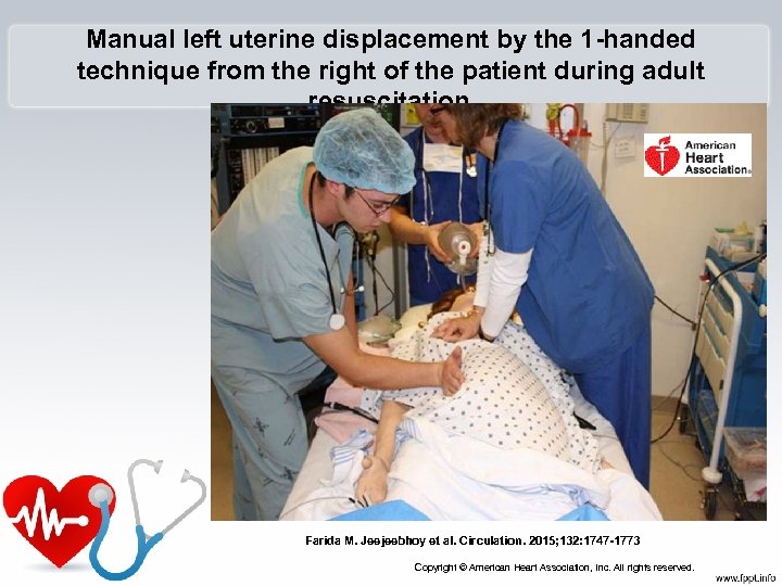 Manual left uterine displacement by the 1 -handed technique from the right of the