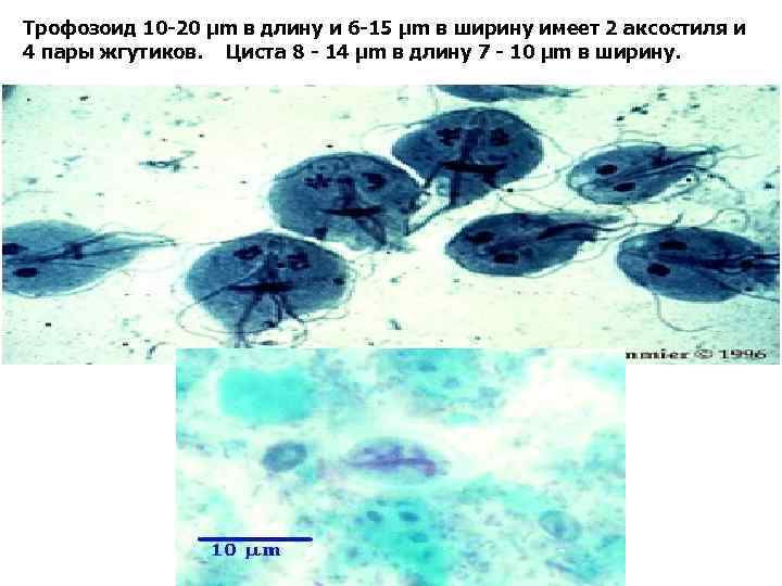 Трофозоид 10 -20 µm в длину и 6 -15 µm в ширину имеет 2