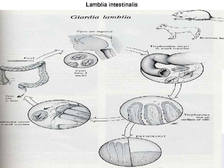 Lamblia intestinalis 