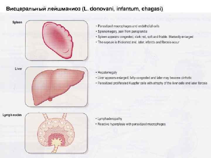 Висцеральный лейшманиоз (L. donovani, infantum, chagasi) 