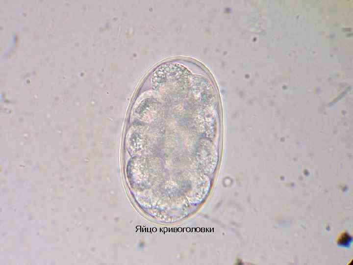 Яйцо кривоголовки 