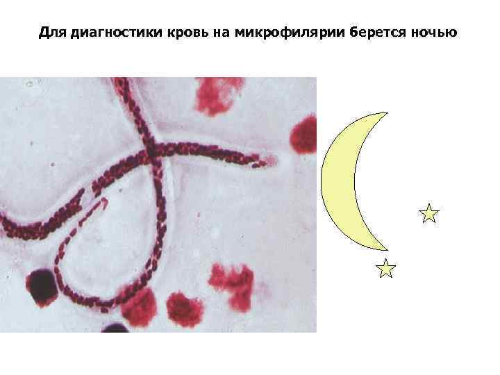 Для диагностики кровь на микрофилярии берется ночью 