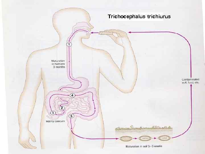 Trichocephalus trichiurus 