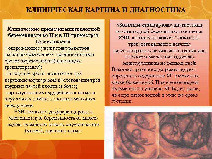 КЛИНИЧЕСКАЯ КАРТИНА И ДИАГНОСТИКА Клинические признаки многоплодной беременности во II и в III триместрах