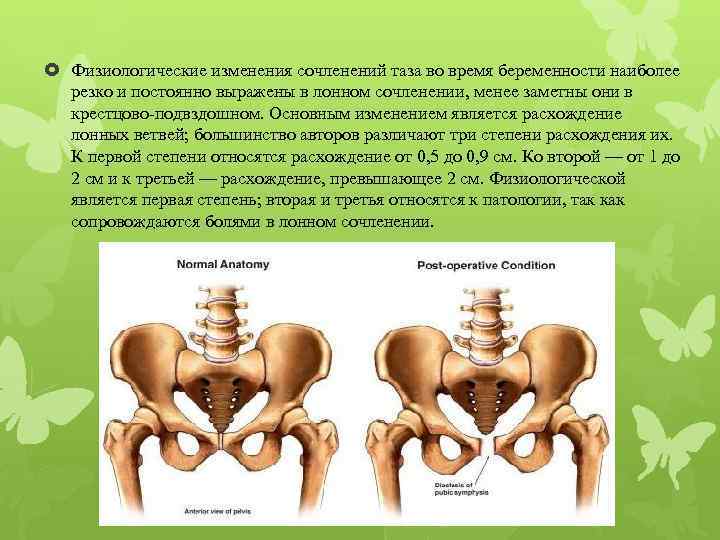  Физиологические изменения сочленений таза во время беременности наиболее резко и постоянно выражены в