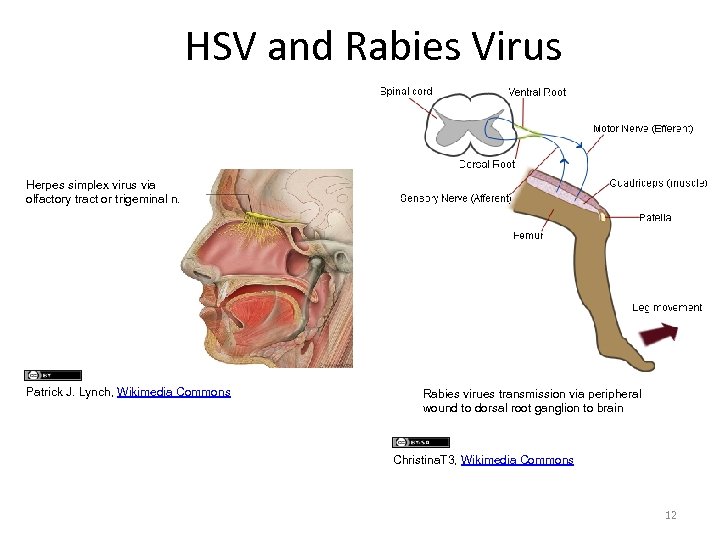 HSV and Rabies Virus Herpes simplex virus via olfactory tract or trigeminal n. Patrick
