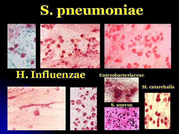 S. pneumoniae H. Influenzae Enterobacteriaceae M. catarrhalis S. aureus 