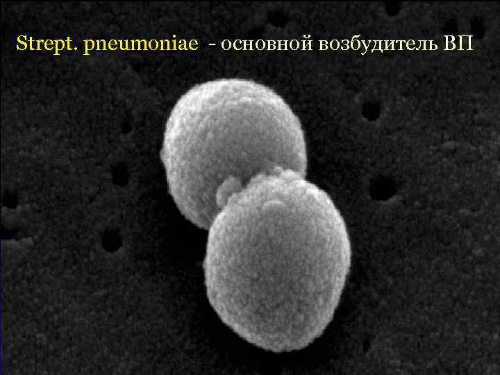 Strept. pneumoniae - основной возбудитель ВП 