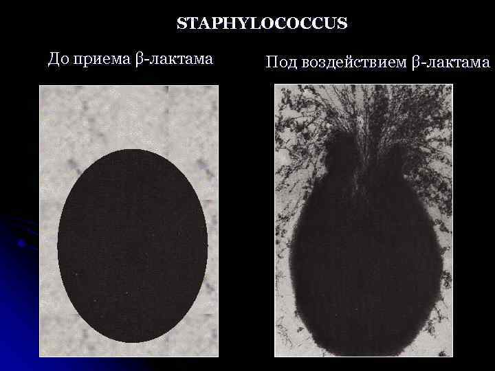 STAPHYLOCOCCUS До приема β-лактама Под воздействием β-лактама 