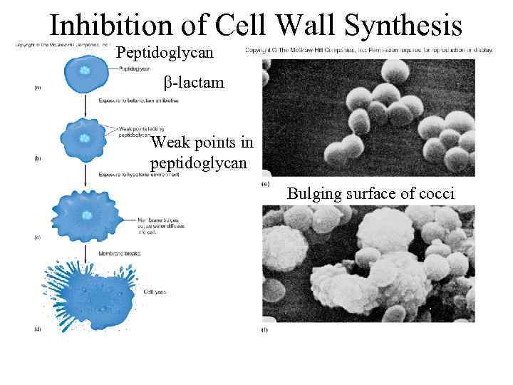 Inhibition of Cell Wall Synthesis Peptidoglycan b-lactam Weak points in peptidoglycan Bulging surface of