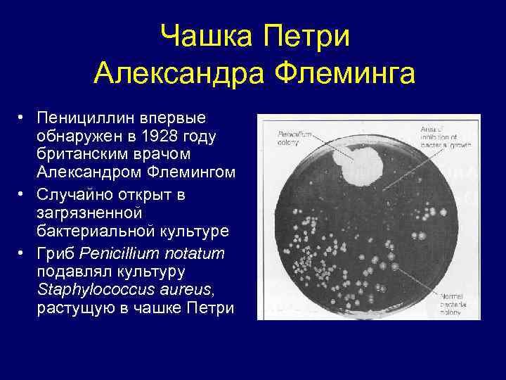 Чашка Петри Александра Флеминга • Пенициллин впервые обнаружен в 1928 году британским врачом Александром