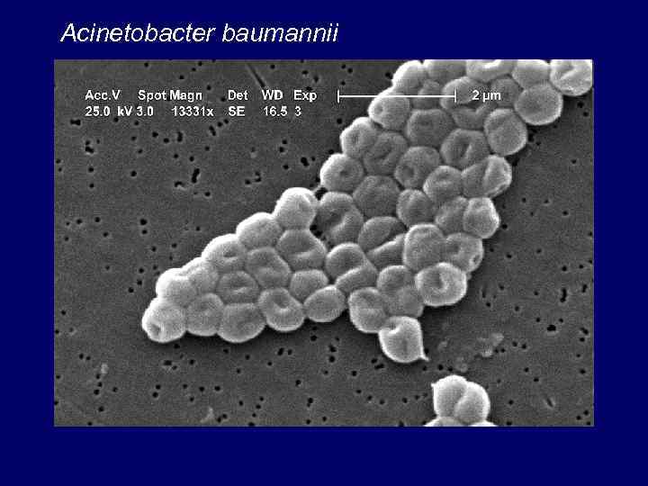 Acinetobacter baumannii 