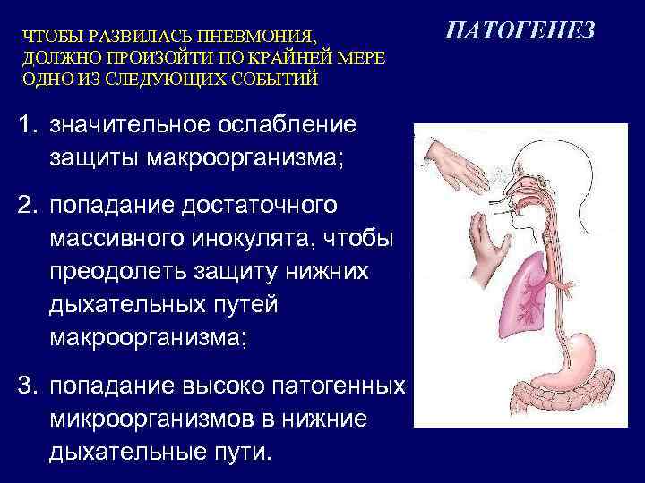 ЧТОБЫ РАЗВИЛАСЬ ПНЕВМОНИЯ, ДОЛЖНО ПРОИЗОЙТИ ПО КРАЙНЕЙ МЕРЕ ОДНО ИЗ СЛЕДУЮЩИХ СОБЫТИЙ 1. значительное
