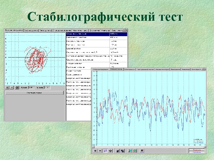 Cтабилографический тест 