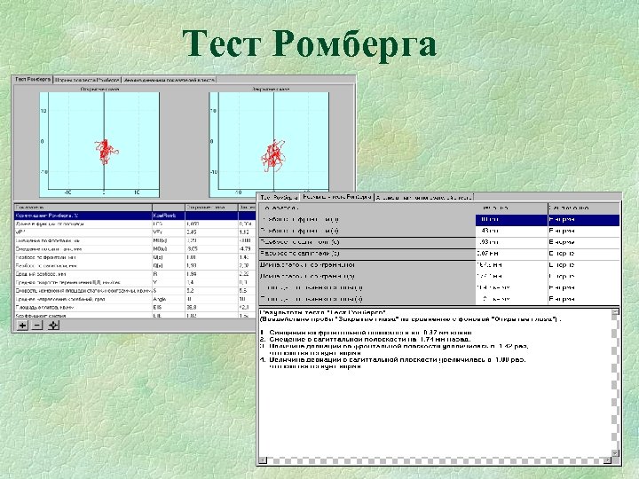 Тест Ромберга 