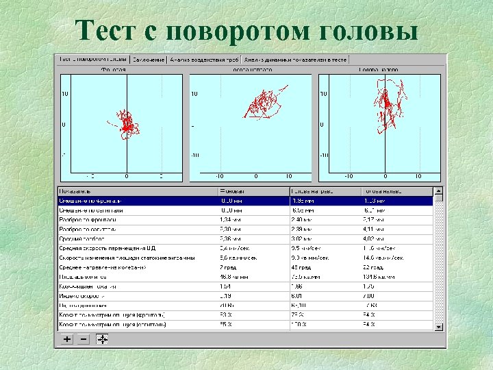 Тест с поворотом головы 
