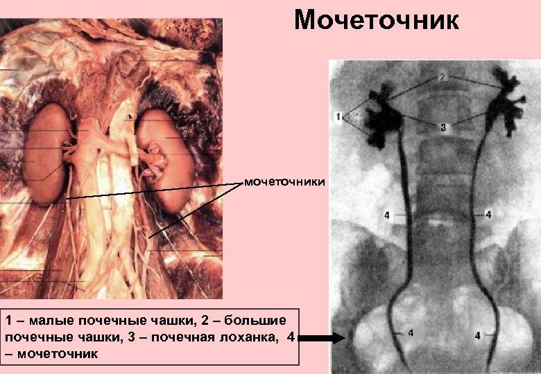 Мочеточник мочеточники 1 – малые почечные чашки, 2 – большие почечные чашки, 3 –