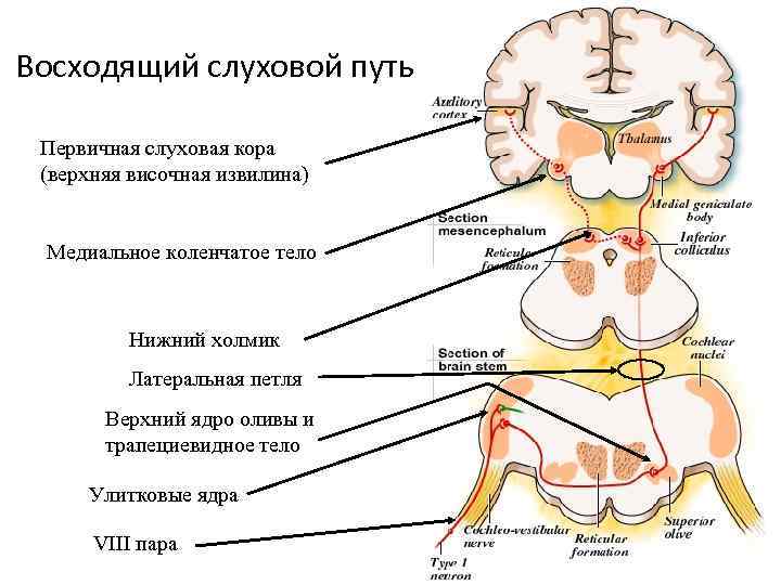 Восходящий слуховой путь Первичная слуховая кора (верхняя височная извилина) Медиальное коленчатое тело Нижний холмик