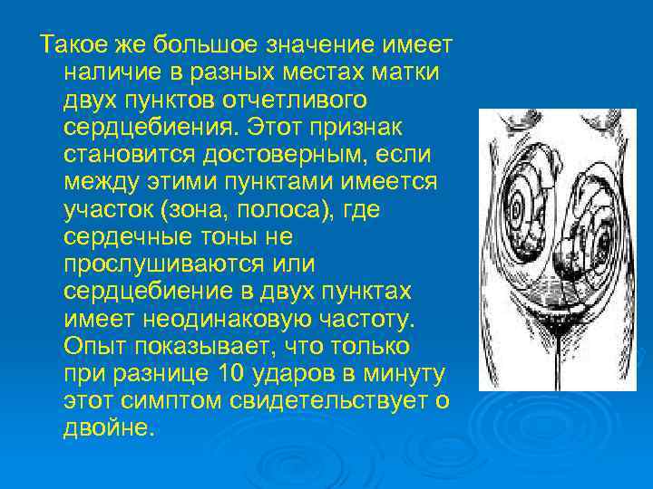 Такое же большое значение имеет наличие в разных местах матки двух пунктов отчетливого сердцебиения.