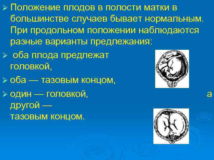 Ø Положение плодов в полости матки в большинстве случаев бывает нормальным. При продольном положении