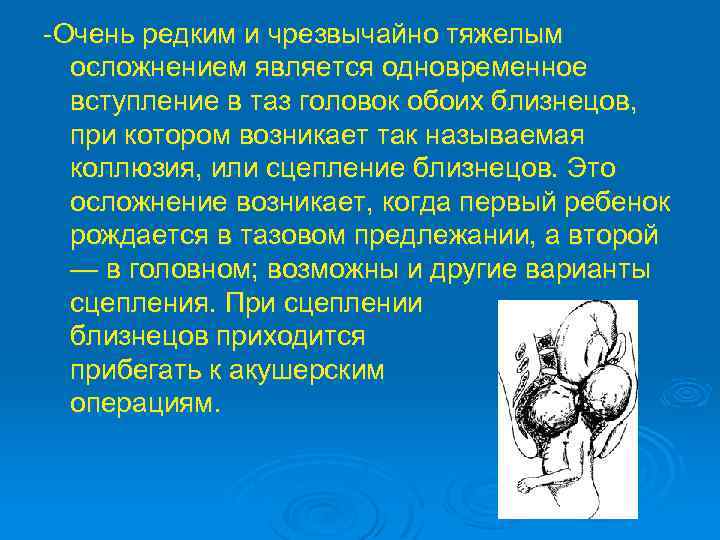 -Очень редким и чрезвычайно тяжелым осложнением является одновременное вступление в таз головок обоих близнецов,