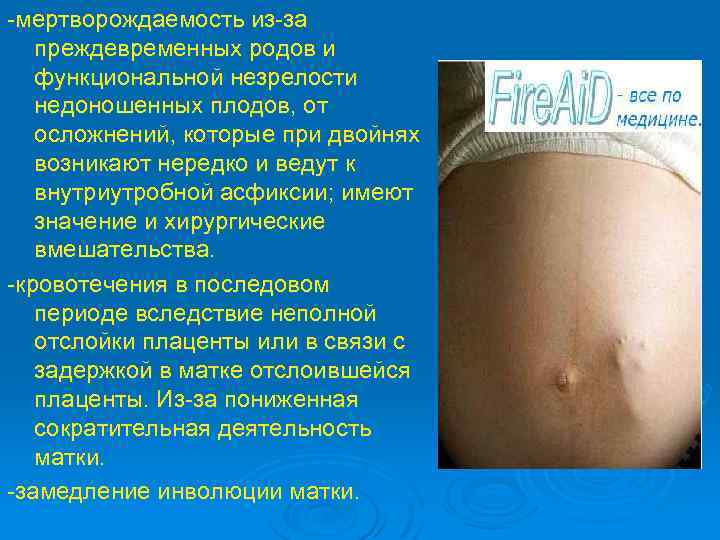 -мертворождаемость из-за преждевременных родов и функциональной незрелости недоношенных плодов, от осложнений, которые при двойнях