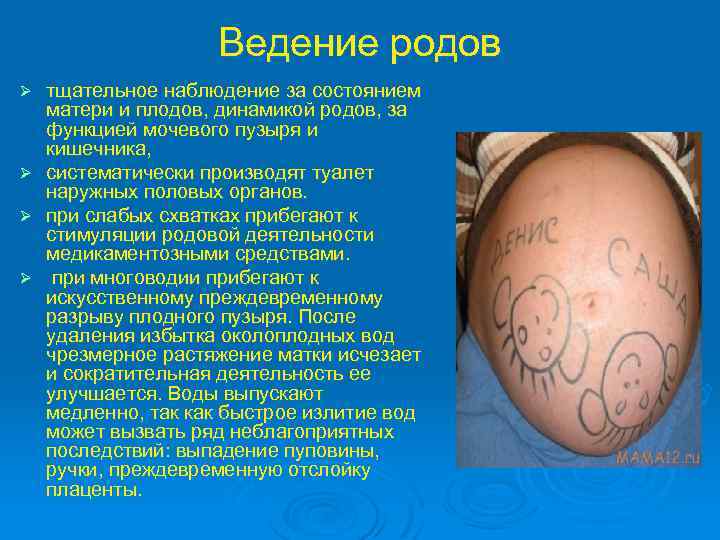 Ведение родов тщательное наблюдение за состоянием матери и плодов, динамикой родов, за функцией мочевого