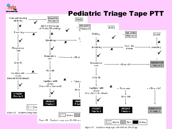 Pediatric Triage Tape PTT 