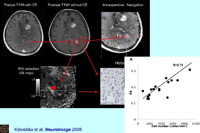Kinoshita et al. Neuro. Image 2008 Kei Yamada 