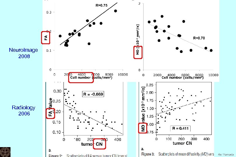 Neuro. Image 2008 Radiology 2006 Kei Yamada 