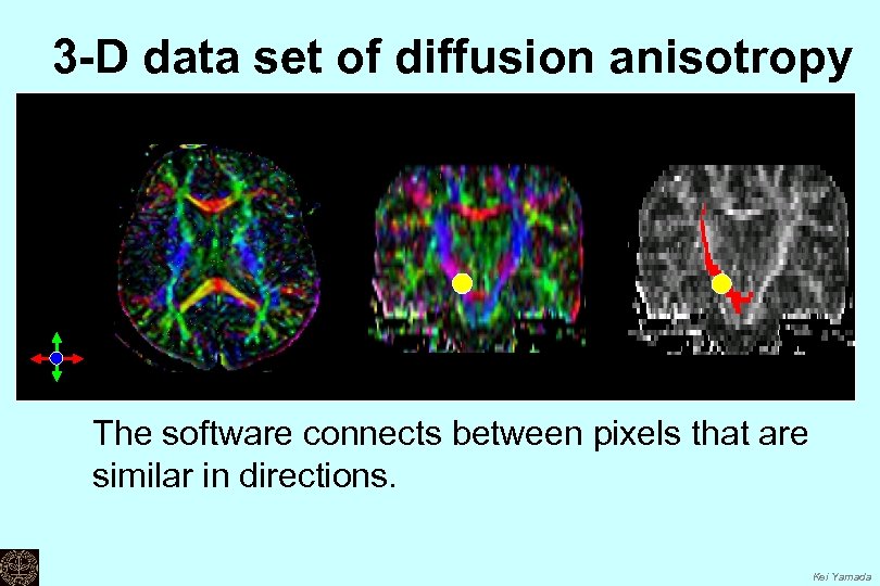 3 -D data set of diffusion anisotropy The software connects between pixels that are