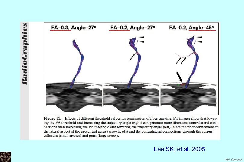 Lee SK, et al. 2005 Kei Yamada 