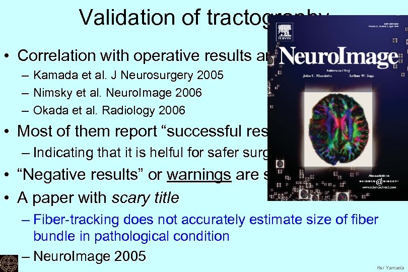 Validation of tractography • Correlation with operative results and/or navigation – Kamada et al.
