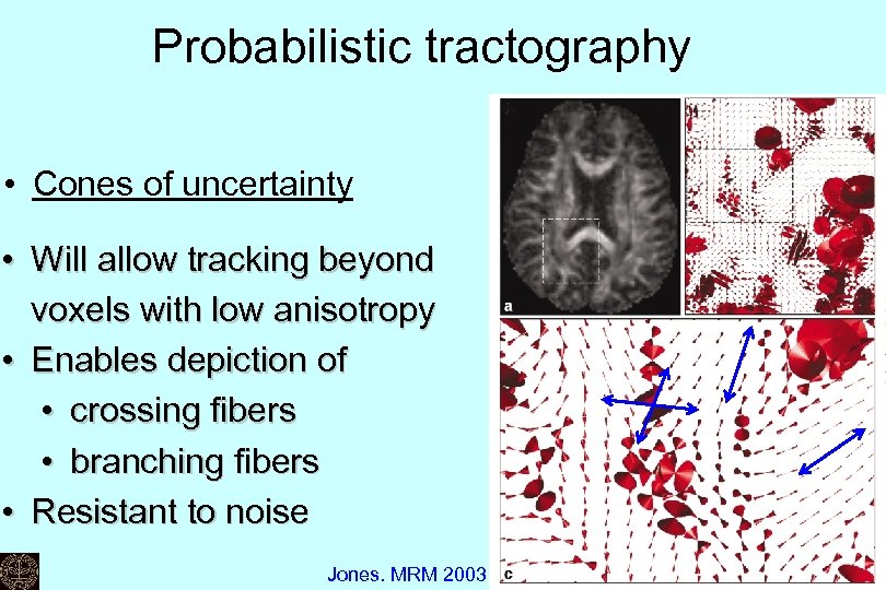 Probabilistic tractography • Cones of uncertainty • Will allow tracking beyond voxels with low