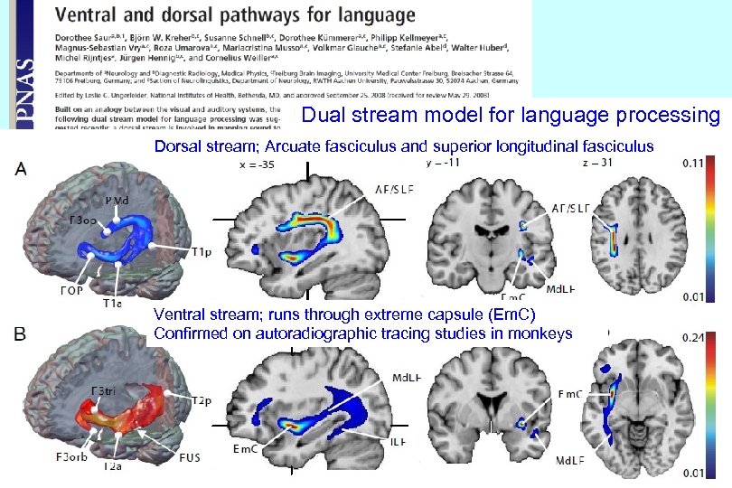 Dual stream model for language processing Dorsal stream; Arcuate fasciculus and superior longitudinal fasciculus