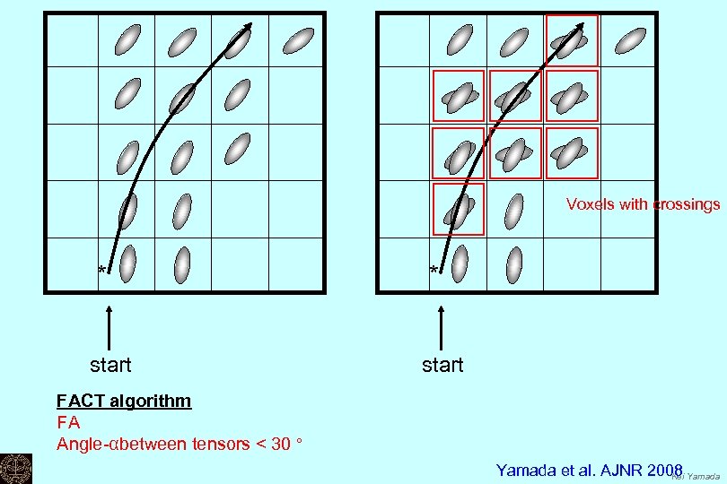 Voxels with crossings * start FACT algorithm FA Angle-αbetween tensors < 30 ° Yamada