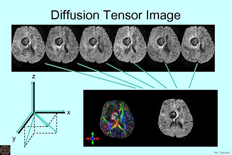 Diffusion Tensor Image z x y Kei Yamada 