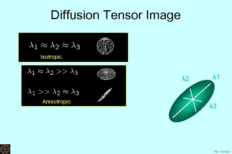 Diffusion Tensor Image Isotropic λ 2 Anisotropic λ 1 λ 3 Kei Yamada 