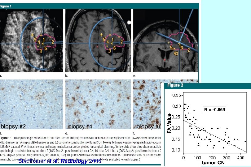 Stadlbauer et al. Radiology 2006 Kei Yamada 